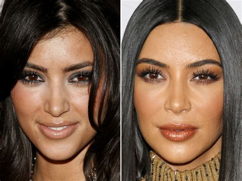 What Plastic Surgery Has Kim Kardashian Had: A Deep Dive into Celebrity Transformations and Public Perception